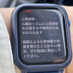 【すごい】SSTR参…