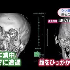 【クマ被害】消防隊員…