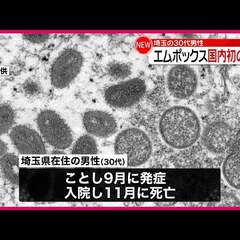 【動画】感染症・エム…