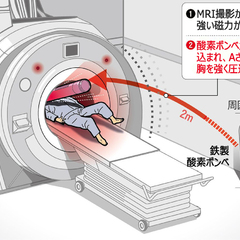 【韓国】MRIが磁力…